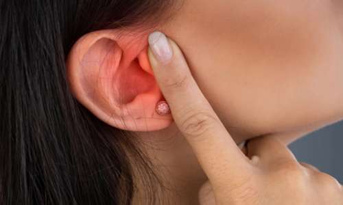 कान की सूजन को इन नुस्खों से करें ठीक, असहनीय पीड़ा से तुरंत मिलेगा आराम